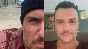 Rodrigo Lombardi posa com cicatriz no rosto e aumenta suspeitas de retorno a ‘Verdades Secretas’ - Instagram