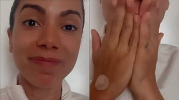 Abatida, Anitta surge com curativos e sonda escondida no pescoço: "Ela tá bem?" - Reprodução/Instagram
