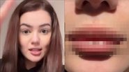 Ex-BBB Eslovênia Marques mostra a boca deformada após sofrer ataque: "Bizarro" - Reprodução/Instagram