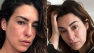Fernanda Paes Leme lamenta saúde de companheira e desabafa na web: "Piorou do nada" - Reprodução/ Instagram