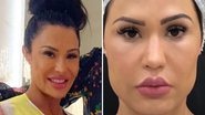 A musa fitness Gracyanne Barbosa faz procedimento estético no rosto e mudança impressiona fãs com antes e depois; confira - Reprodução/Instagram