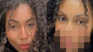 Irmã de Gracyanne Barbosa passa por cirurgia radical no rosto e mostra resultado - Reprodução/Instagram