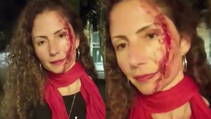 Magalea Mazziotti foi agredida na rua ao andar com um adesivo à favor de Luiz Inácio Lula da Silva - Reprodução/Instagram