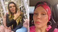 A cantora Simony lamenta queda de cabelo durante tratamento de câncer; confira - Reprodução/Instagram