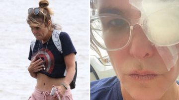 Cristiana Oliveira assusta fãs ao mostrar acidente durante caminhada ao ar livre: "Um passeio inofensivo" - Reprodução/Instagram