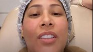 De cara lavada, Simaria passa por procedimento no rosto: "Cansei de tanta feiura" - Reprodução/ Instagram