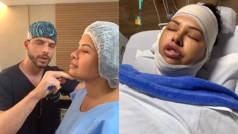 Ariadna Arantes momentos antes e pós cirurgia plástica - Reprodução/Instagram