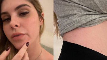 Aos dois meses, Bárbara Evans mostra barriguinha de grávida e relata crise de espinhas no rosto: "Sem filtro" - Reprodução/Instagram