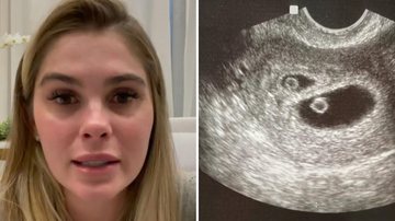 Após anunciar gravidez de gêmeos, Bárbara Evans expõe situação delicada sobre um dos embriões: “Rezem, orem” - Reprodução/Instagram