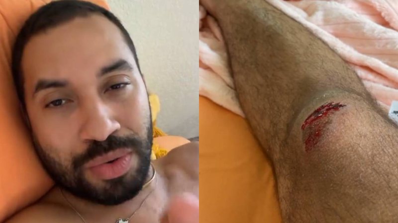 Ex-BBB Gil do Vigor surge ensanguentado após sofrer acidente de bicicleta nos EUA: "Quase desmaiei" - Reprodução/Instagram