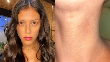 Atriz da TV Globo mostra hematomas no corpo após sofrer agressão por ataque transfóbico: "Sem chão" - Reprodução/Instagram