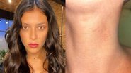Atriz da TV Globo mostra hematomas no corpo após sofrer agressão por ataque transfóbico: "Sem chão" - Reprodução/Instagram