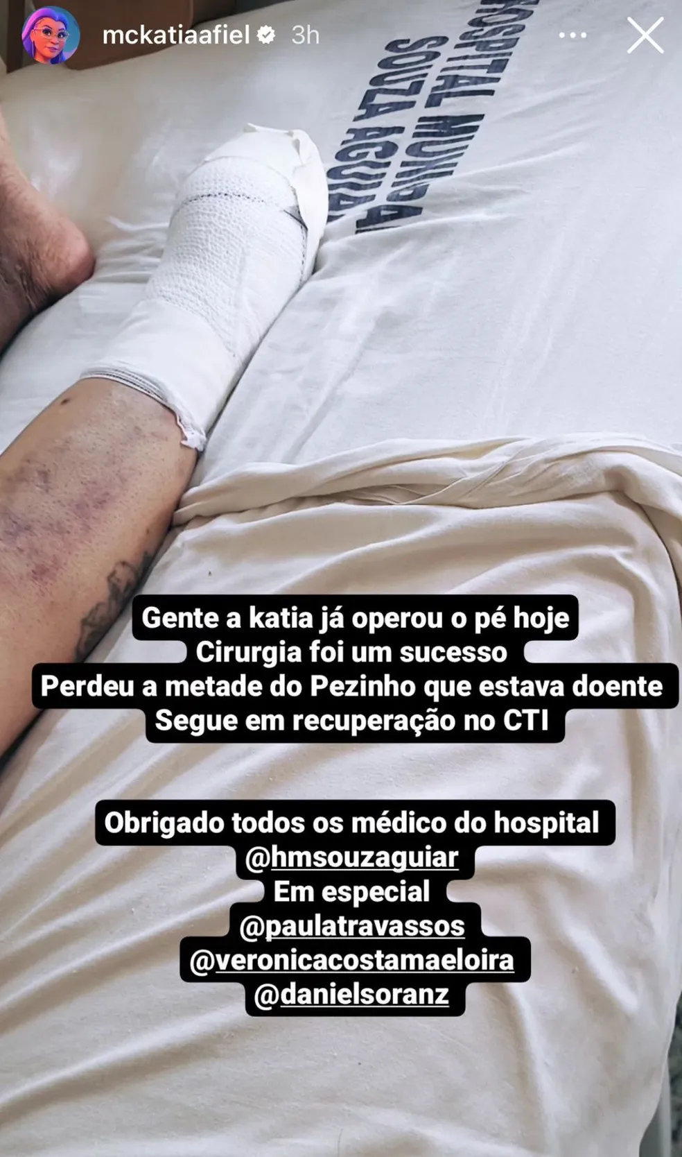 Pioneira do funk, MC Katia mostra pé amputado após cirurgia delicada: "Já operou"