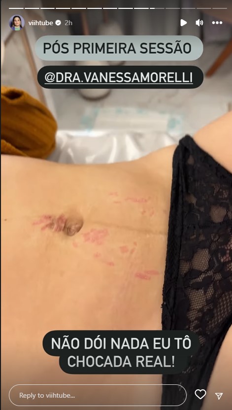Viih Tube mostra eliminação de estrias na barriga dois meses pós-parto: "Tô chocada"