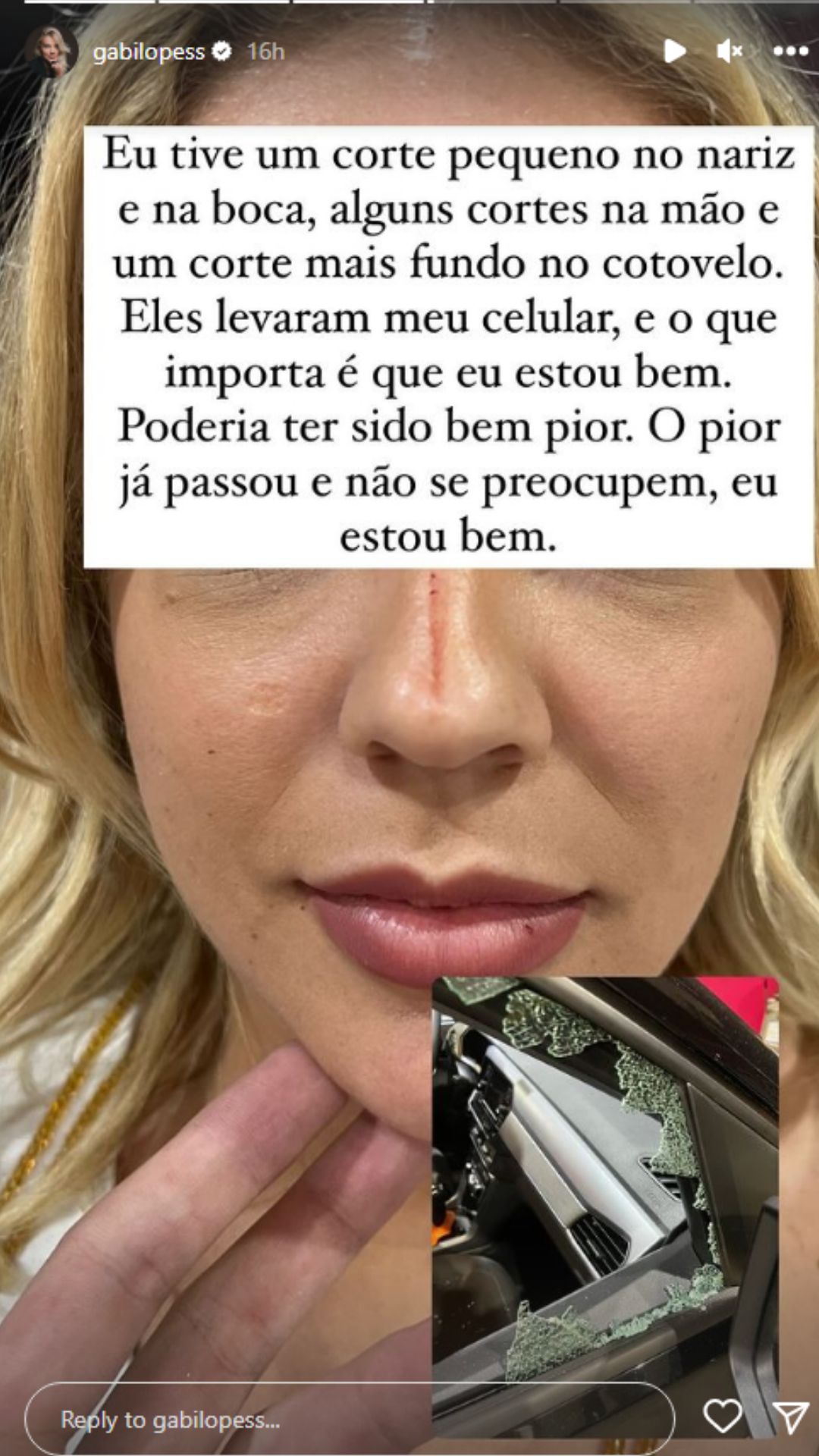 Gabi Lopes corre para o hospital após ser assaltada em São Paulo: "Filme de terror"