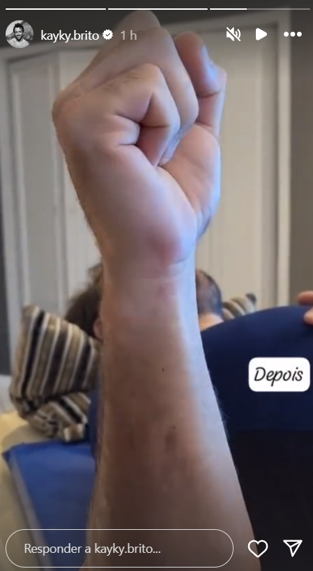 Kayky Brito recupera movimento do braço após fisioterapia: "Não desista"