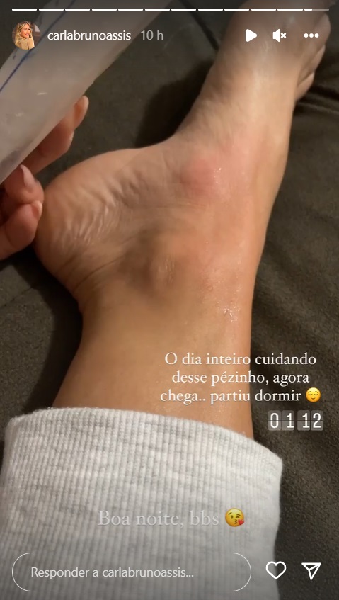 Bailarina do 'Domingão' sofre acidente e diagnóstico revela anormalidade: "Doendo"