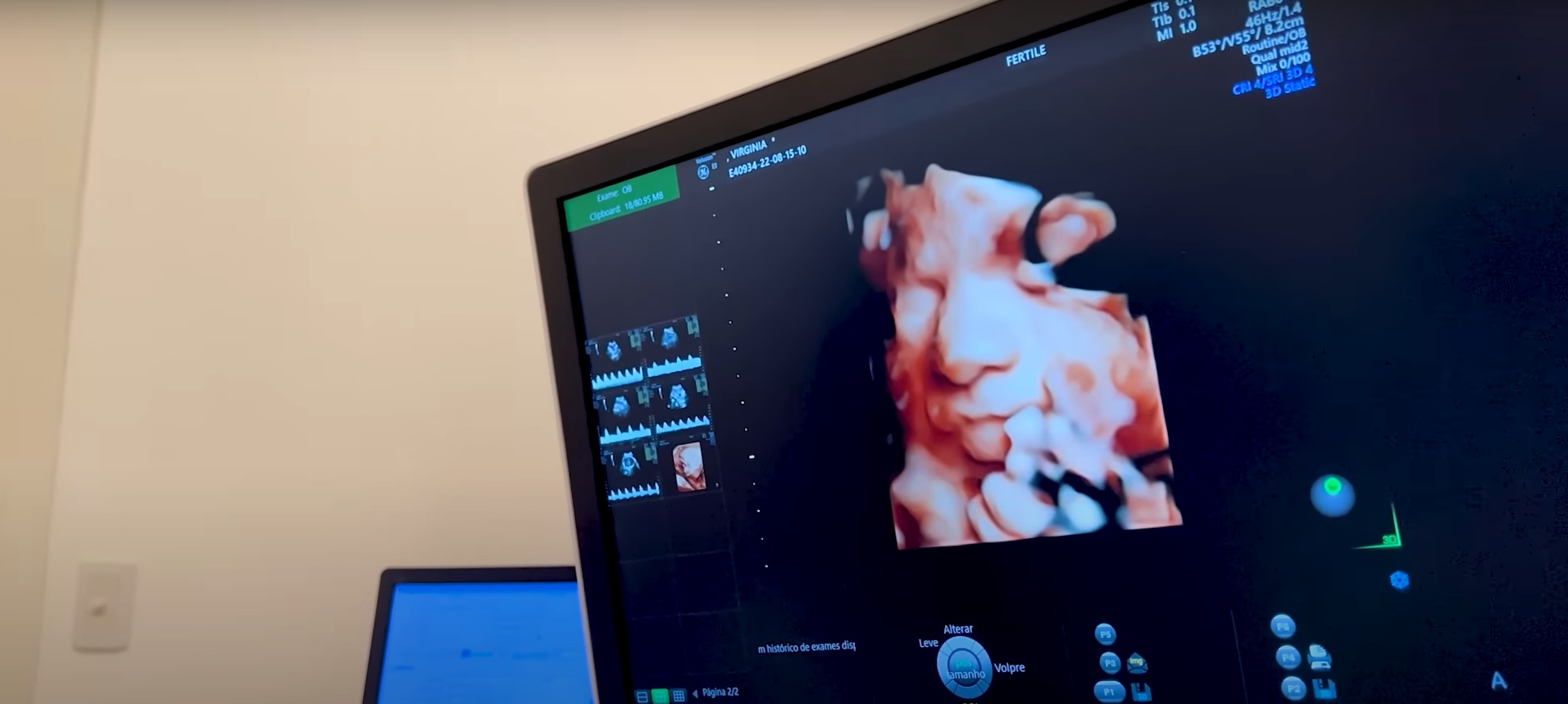 Virgínia Fonseca mostra rostinho da caçula em ultrassom 3D: "Parece a Maria Alice"