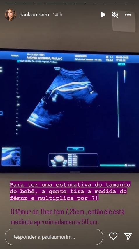 Na reta final, ex-BBB Paula Amorim fica preocupada após novo ultrassom: "Susto"