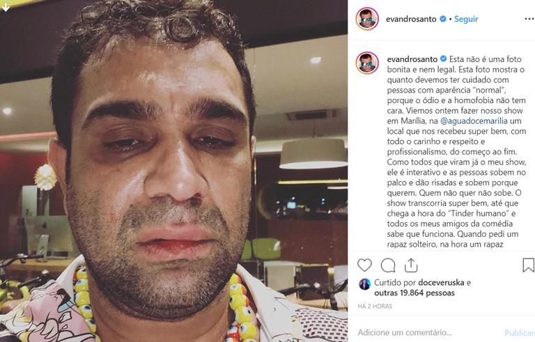 Evandro Santo é agredido após show e faz acusação de homofobia