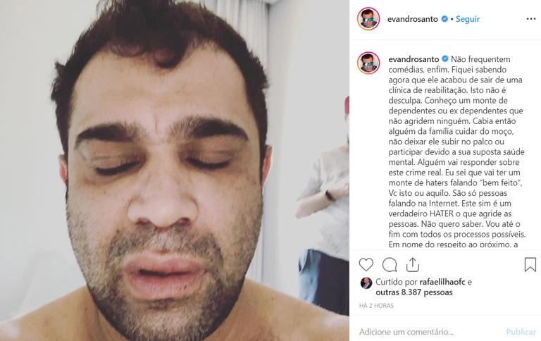 Evandro Santo é agredido após show e faz acusação de homofobia