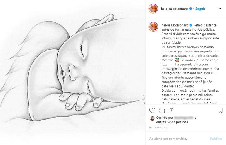 Heloísa Bolsonaro revela aborto espontâneo
