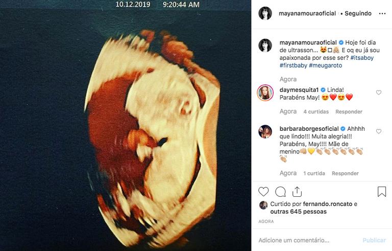 Grávida, Mayana Moura mostra foto do ultrassom do primeiro filho