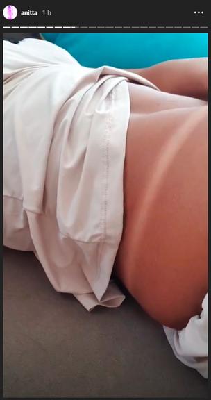 Anitta abaixa a roupa para mostrar marquinha