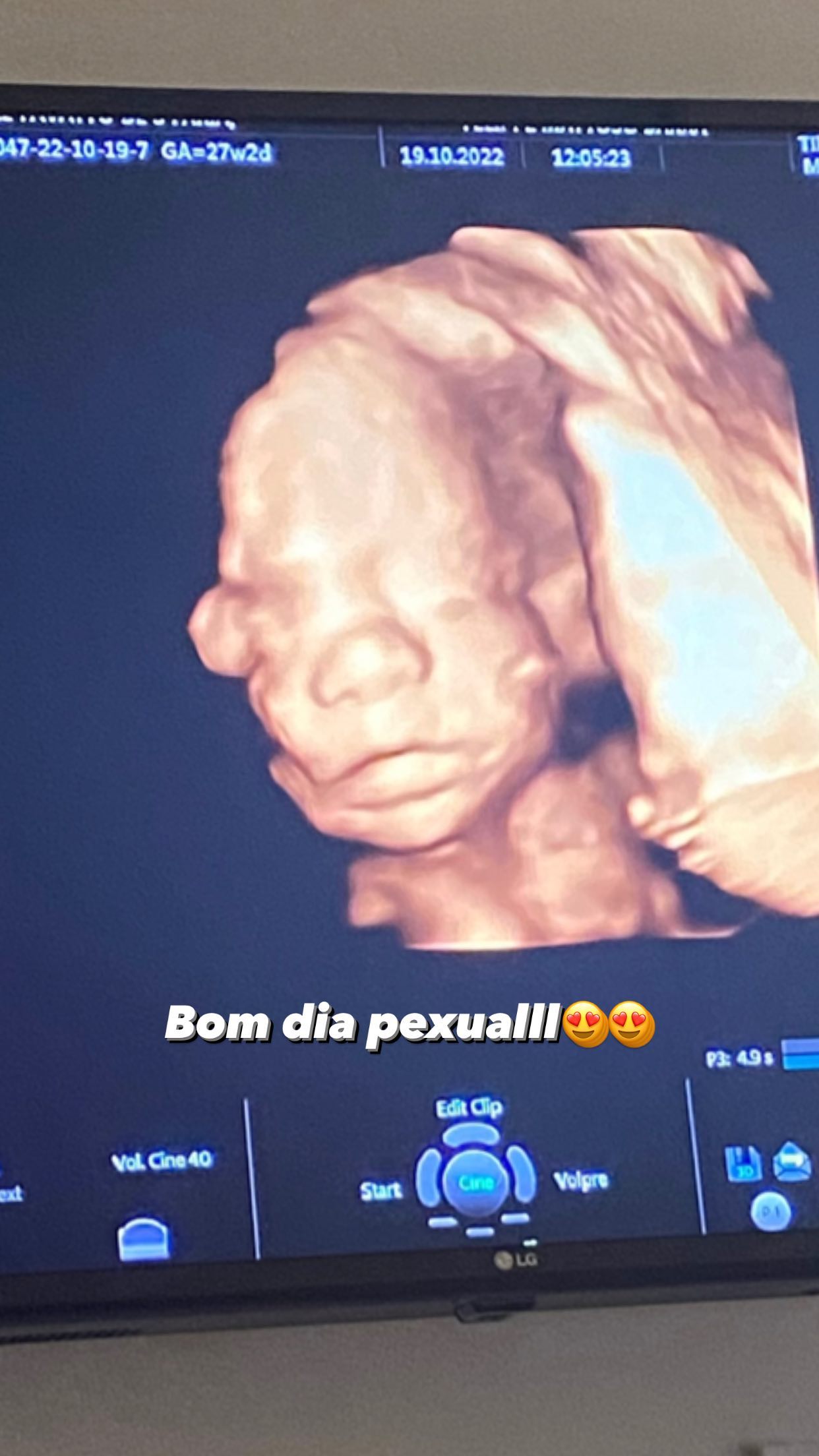 Grávida, filha de Romário mostra rostinho da bebê em ultrassom 3D: "Bom dia"