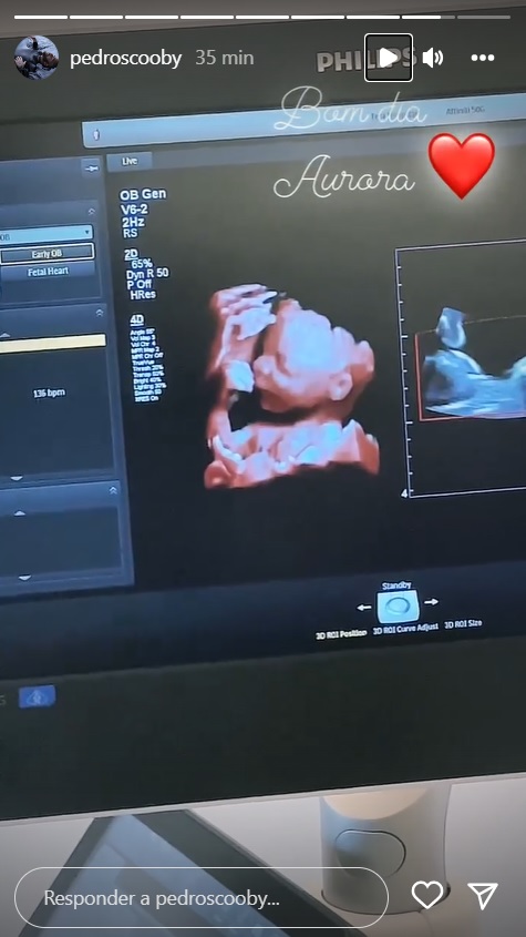Ex-BBB Pedro Scooby mostra rostinho da filha em ultrassom 3D: "Eu te amo"